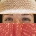 Pecas, lunares y manchas. Diferencias y prevención